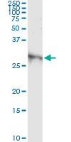 5 - DKK1 Antibody (monoclonal) (M08) AT1768a