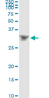 5 - DLX4 Antibody (monoclonal) (M01) AT1780a