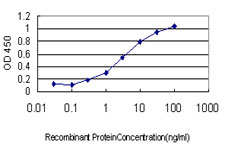 10 - DNAJB2 Antibody (monoclonal) (M03) AT1790a
