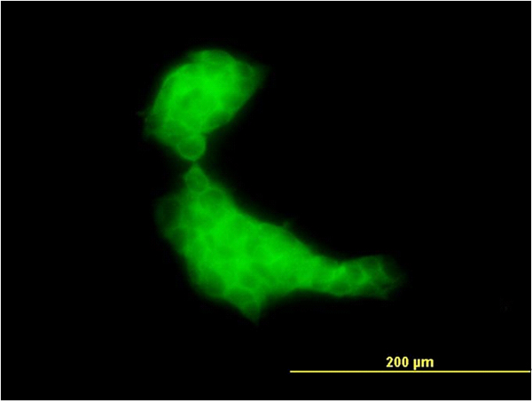 3 - DNAJB2 Antibody (monoclonal) (M03) AT1790a