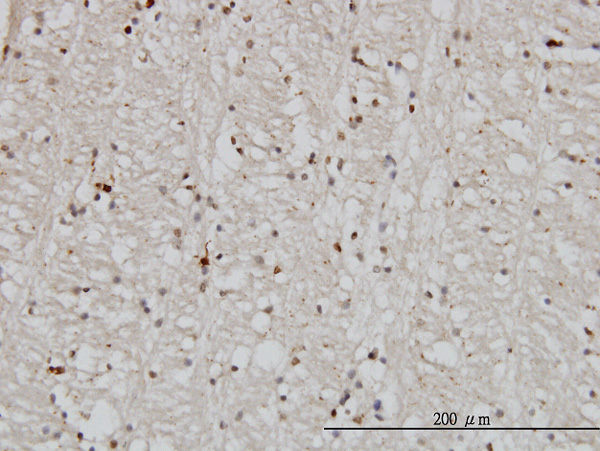 2 - DNAJB2 Antibody (monoclonal) (M03) AT1790a
