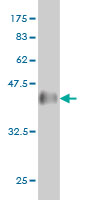 1 - DNAJB2 Antibody (monoclonal) (M03) AT1790a