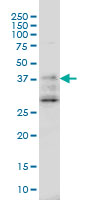 1 - DNAJB2 Antibody (monoclonal) (M03) AT1790a