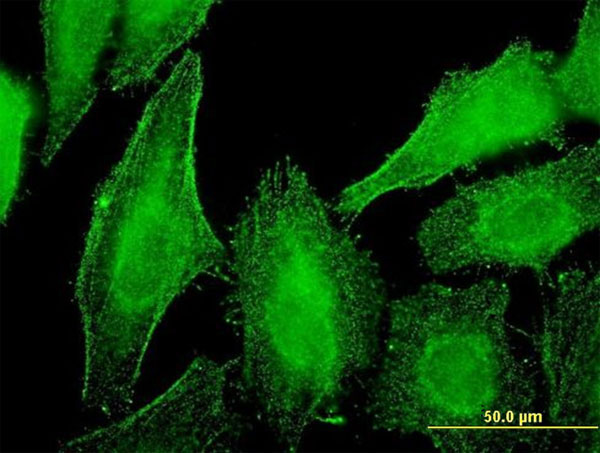 3 - DST Antibody (monoclonal) (M01) AT1822a