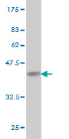 1 - DST Antibody (monoclonal) (M01) AT1822a