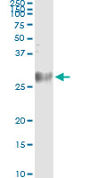 5 - DSU Antibody (monoclonal) (M01) AT1823a