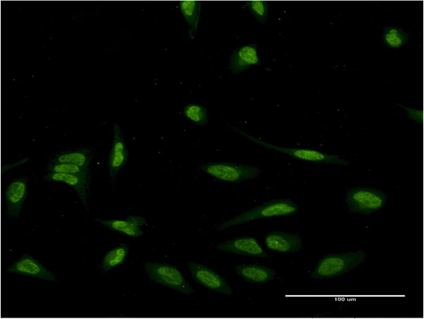 3 - EIF4EBP3 Antibody (monoclonal) (M05) AT1878a