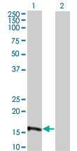 1 - EIF4EBP3 Antibody (monoclonal) (M05) AT1878a
