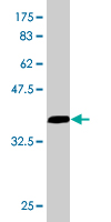 1 - EIF4G1 Antibody (monoclonal) (M01) AT1880a