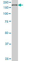 1 - EIF4G1 Antibody (monoclonal) (M01) AT1880a