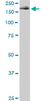 1 - EIF4G1 Antibody (monoclonal) (M01) AT1880a