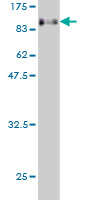 1 - EIF4G3 Antibody (monoclonal) (M02) AT1883a