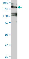 1 - EIF4G3 Antibody (monoclonal) (M02) AT1883a