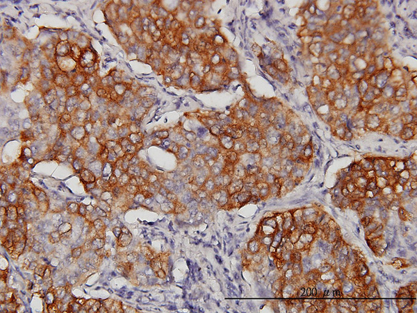 2 - EIF4G3 Antibody (monoclonal) (M03) AT1884a