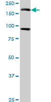 1 - EIF4G3 Antibody (monoclonal) (M03) AT1884a