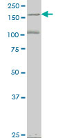 1 - EIF4G3 Antibody (monoclonal) (M03) AT1884a