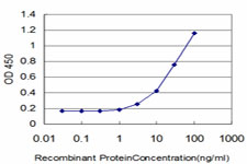 10 - EIF4G3 Antibody (monoclonal) (M03) AT1884a