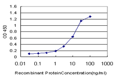 10 - ELAC1 Antibody (monoclonal) (M01) AT1890a