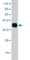 1 - ELAC1 Antibody (monoclonal) (M01) AT1890a