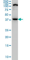 1 - ELAC1 Antibody (monoclonal) (M01) AT1890a