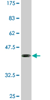 1 - ELF5 Antibody (monoclonal) (M01) AT1896a