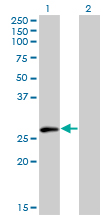 1 - ELF5 Antibody (monoclonal) (M01) AT1896a
