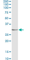 5 - EPDR1 Antibody (monoclonal) (M01) AT1924a