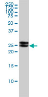 1 - EPDR1 Antibody (monoclonal) (M01) AT1924a