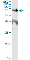 5 - EPOR Antibody (monoclonal) (M01) AT1931a