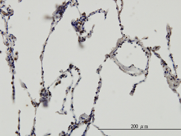 2 - ERH Antibody (monoclonal) (M14) AT1942a