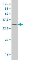 1 - ERH Antibody (monoclonal) (M14) AT1942a