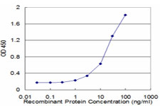 10 - ETF1 Antibody (monoclonal) (M02) AT1951a
