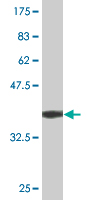1 - ETF1 Antibody (monoclonal) (M02) AT1951a