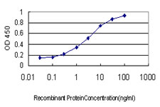 10 - EVL Antibody (monoclonal) (M01) AT1958a