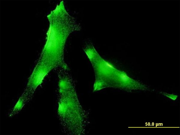 3 - EVL Antibody (monoclonal) (M01) AT1958a