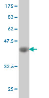 1 - EVL Antibody (monoclonal) (M01) AT1958a