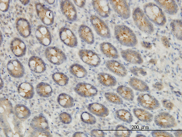 2 - EXOC7 Antibody (monoclonal) (M01) AT1965a