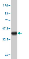 1 - EXOC7 Antibody (monoclonal) (M01) AT1965a