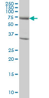 1 - EXOC7 Antibody (monoclonal) (M01) AT1965a