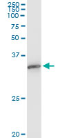 5 - EXOSC3 Antibody (monoclonal) (M03) AT1967a