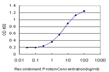 10 - EXOSC5 Antibody (monoclonal) (M01) AT1968a