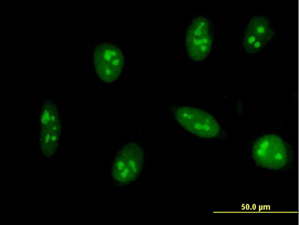 3 - EXOSC5 Antibody (monoclonal) (M01) AT1968a