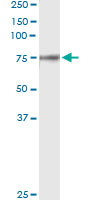 5 - F2 Antibody (monoclonal) (M01) AT1977a