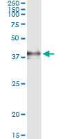 5 - F3 Antibody (monoclonal) (M01) AT1979a