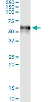 5 - F9 Antibody (monoclonal) (M01) AT1981a