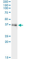 5 - FAM62B Antibody (monoclonal) (M02) AT1994a