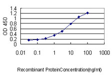 10 - FAM84A Antibody (monoclonal) (M01) AT1995a