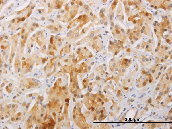 2 - FAM84A Antibody (monoclonal) (M01) AT1995a