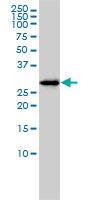 1 - FAM84A Antibody (monoclonal) (M01) AT1995a