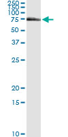 5 - FANCG Antibody (monoclonal) (M01) AT1997a
